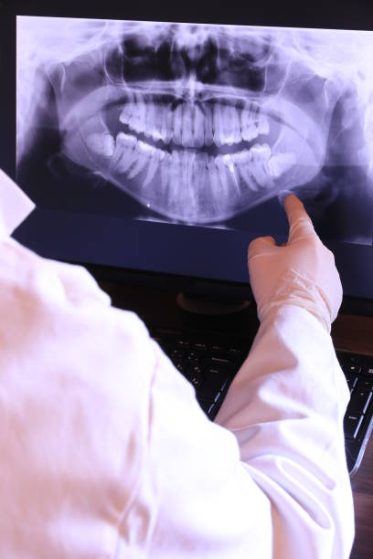 Best Emergency Treatment for Dental Infections or Abscesses in Aurora, SD