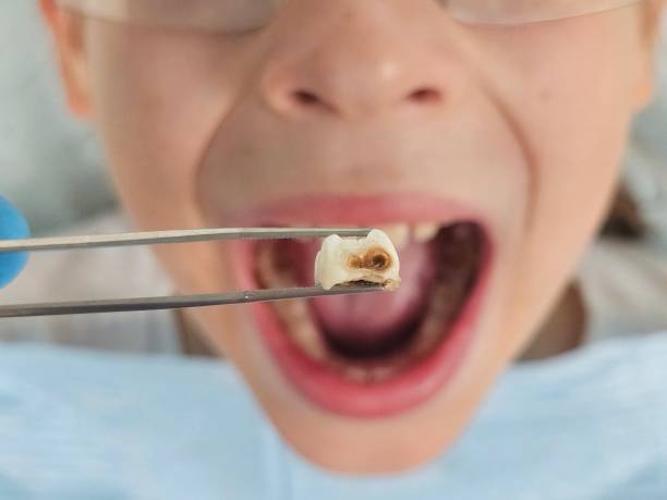 Best Pediatric Emergency Dentist in Aurora, SD